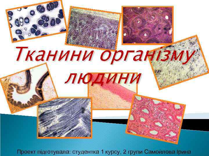 Тканини організму людини Проект підготувала: студентка 1 курсу, 2 групи Самойлова Ірина 