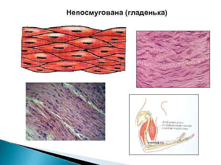 Непосмугована (гладенька) 