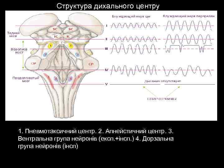 Структура дихального центру 1. Пневмотаксичний центр. 2. Апнейстичний центр. 3. Вентральна група нейронів (експ.
