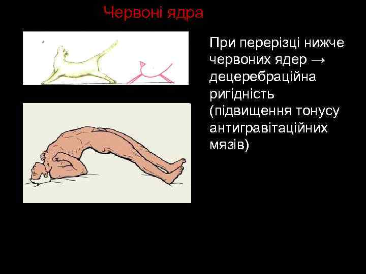 Червоні ядра При перерізці нижче червоних ядер → децеребраційна ригідність (підвищення тонусу антигравітаційних мязів)