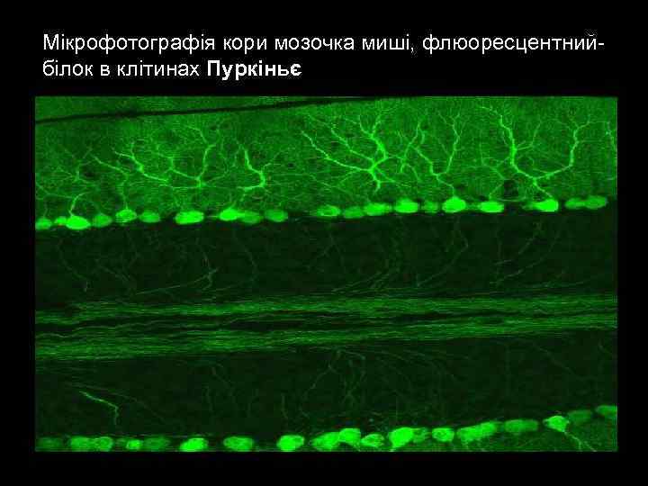 Мікрофотографія кори мозочка миші, флюоресцентнийбілок в клітинах Пуркіньє 