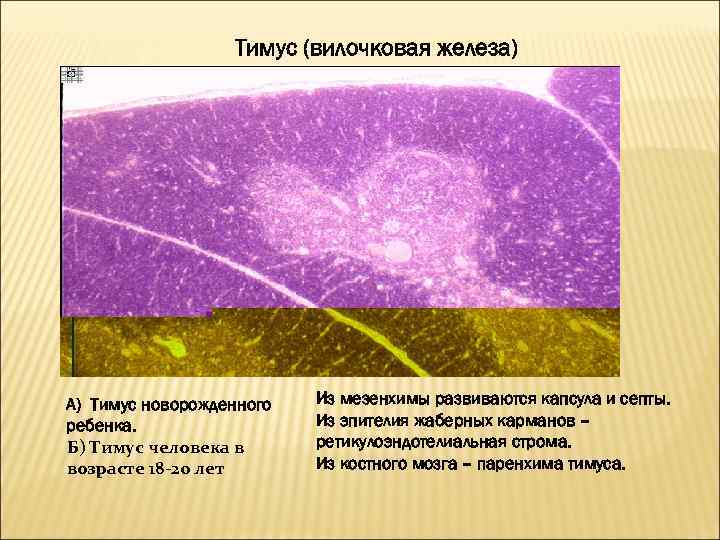 Тимус (вилочковая железа) А) Тимус новорожденного ребенка. Б) Тимус человека в возрасте 18 -20