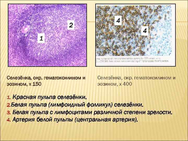 2 ЛИМФАТИЧЕСКИЙ УЗЕЛ 1 Селезёнка, окр. гематоксилином и эозином, х 150 4 4 4