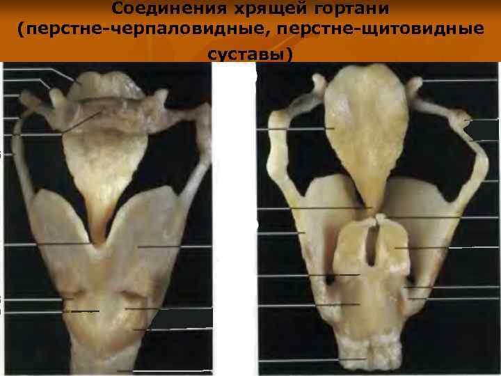 Соединения хрящей гортани (перстне-черпаловидные, перстне-щитовидные суставы) 