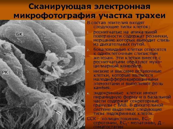 Сканирующая электронная микрофотография участка трахеи В состав эпителия входят следующие типы клеток: 1. реснитчатые
