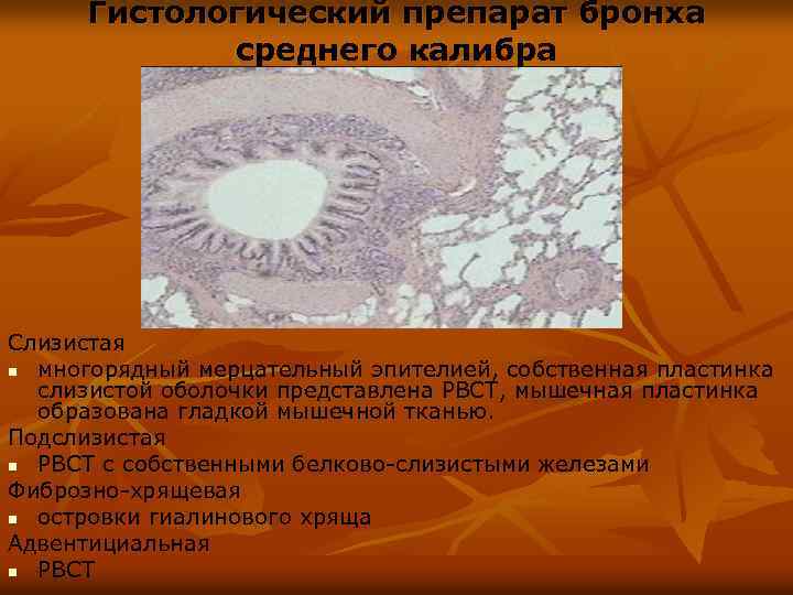 Гистологический препарат бронха среднего калибра Слизистая n многорядный мерцательный эпителией, собственная пластинка слизистой оболочки