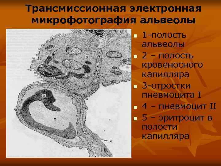 Трансмиссионная электронная микрофотография альвеолы n n n 1 -полость альвеолы 2 – полость кровеносного