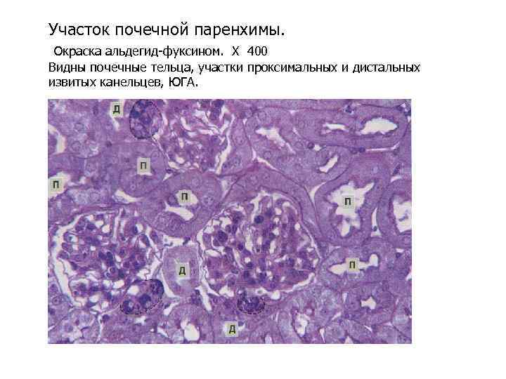 Участок почечной паренхимы. Окраска альдегид-фуксином. Х 400 Видны почечные тельца, участки проксимальных и дистальных