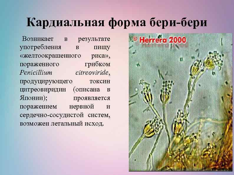Кардиальная форма бери-бери Возникает в результате употребления в пищу «желтоокрашенного риса» , пораженного грибком