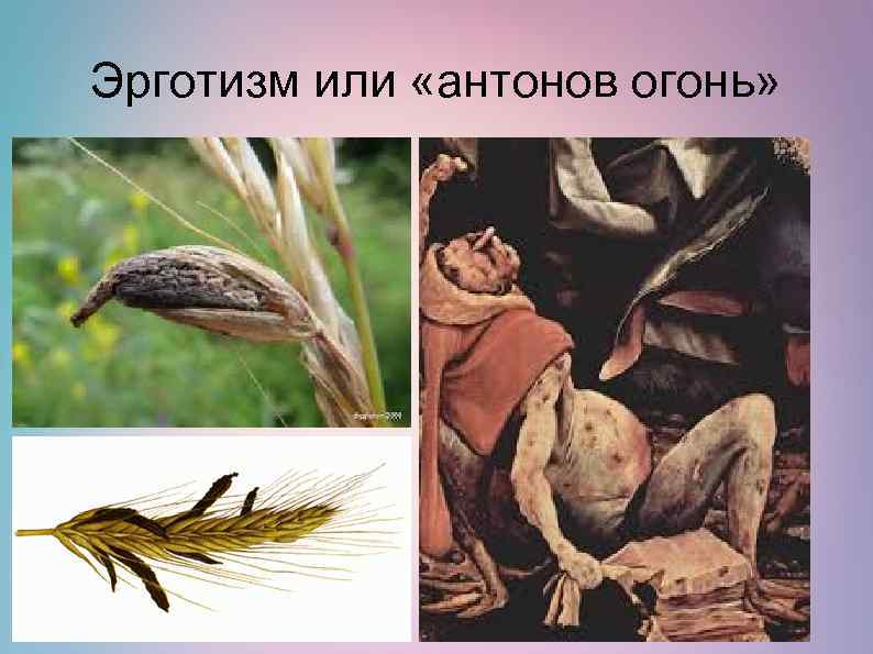 Эрготизм или «антонов огонь» 