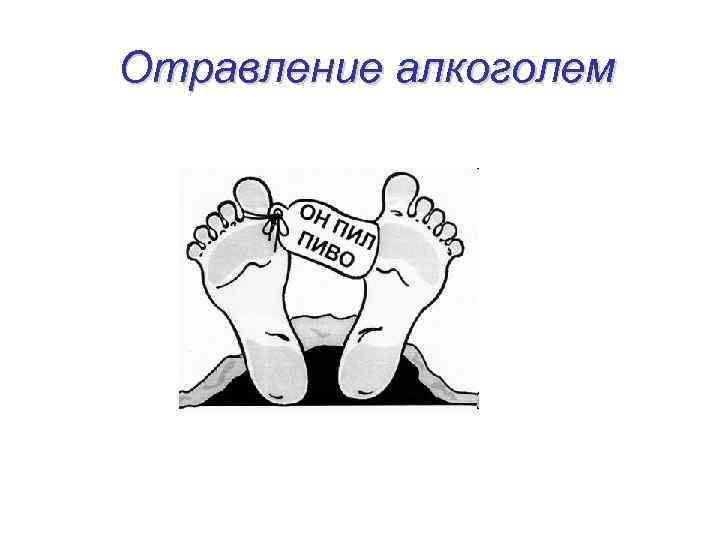 Отравление алкоголем 