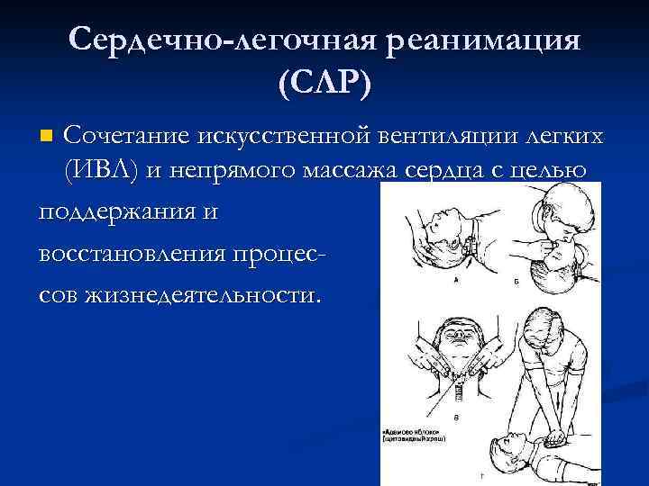 Слр и ивл. Сердечно-легочная реанимация ИВЛ. Основы сердечно-легочной реанимации тесты с ответами. Тест сердечно -легочная реанимация.