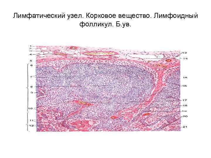 Лимфатический узел рисунок