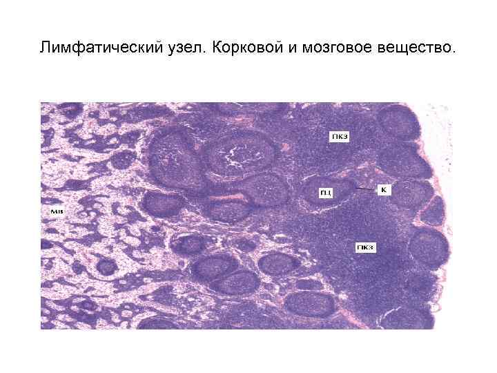 Лимфатический узел. Корковой и мозговое вещество. 