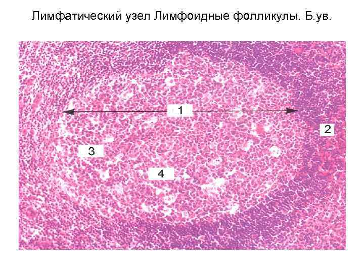 Лимфоидные фолликулы