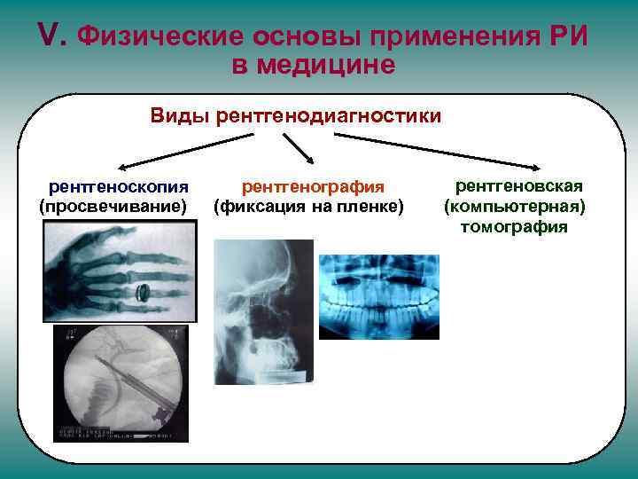 Применение рентгеновского излучения в медицине проект