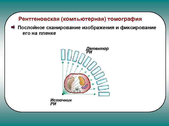 Рентгеновская (компьютерная) томография Послойное сканирование изображения и фиксирование его на пленке Детектор РИ Источник