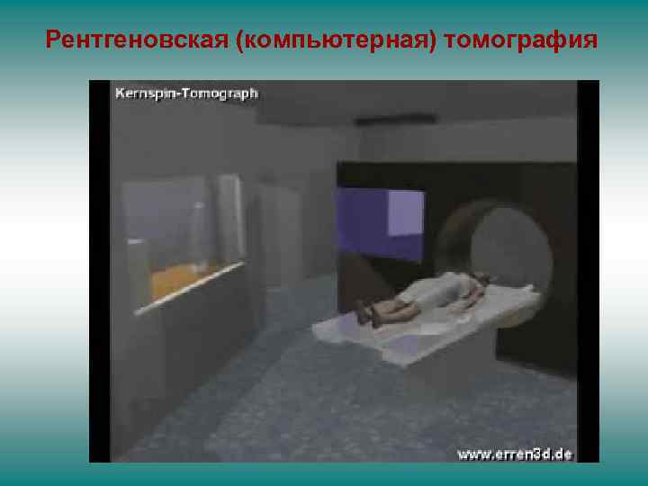 Рентгеновская (компьютерная) томография 