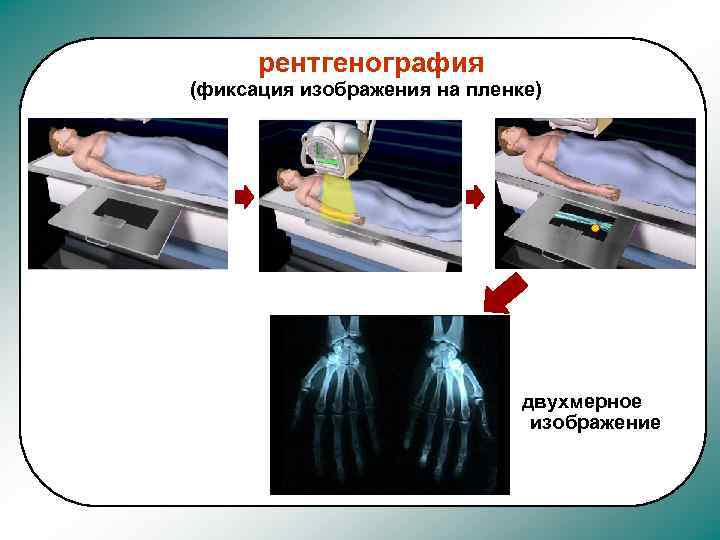 Негативное изображение исследуемого органа на фотопленке