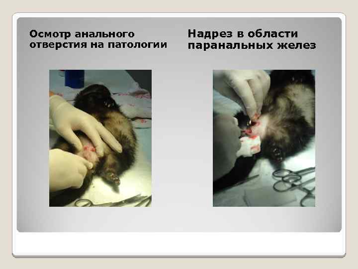 Осмотр анального отверстия на патологии Надрез в области паранальных желез 