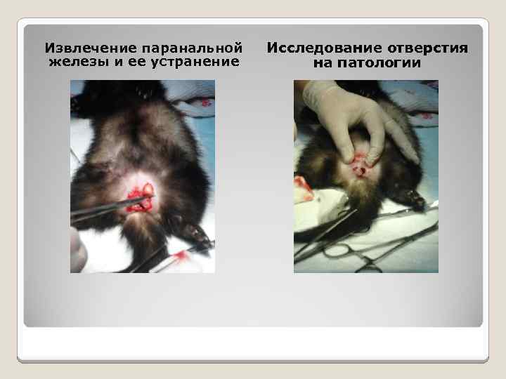 Извлечение паранальной железы и ее устранение Исследование отверстия на патологии 