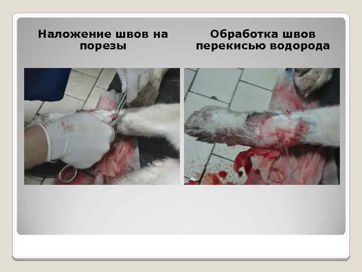 Наложение швов на порезы Обработка швов перекисью водорода 