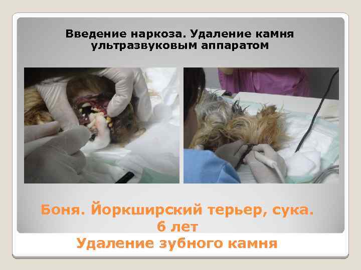 Введение наркоза. Удаление камня ультразвуковым аппаратом Боня. Йоркширский терьер, сука. 6 лет Удаление зубного