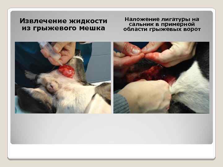 Извлечение жидкости из грыжевого мешка Наложение лигатуры на сальник в примерной области грыжевых ворот