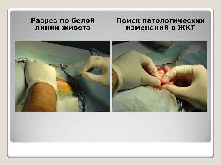 Разрез по белой линии живота Поиск патологических изменений в ЖКТ 
