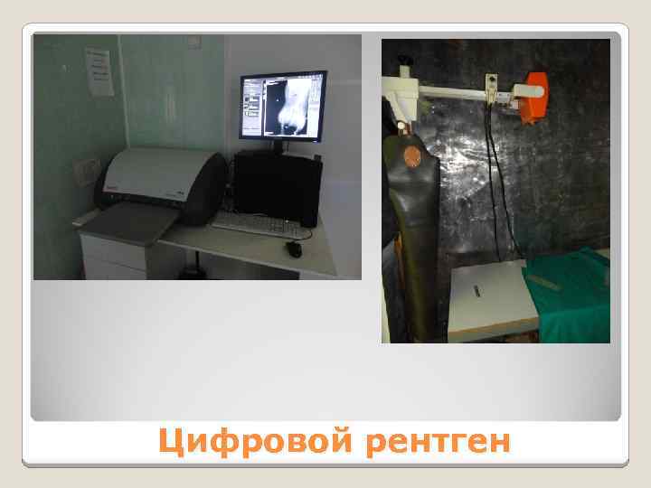 Цифровой рентген 