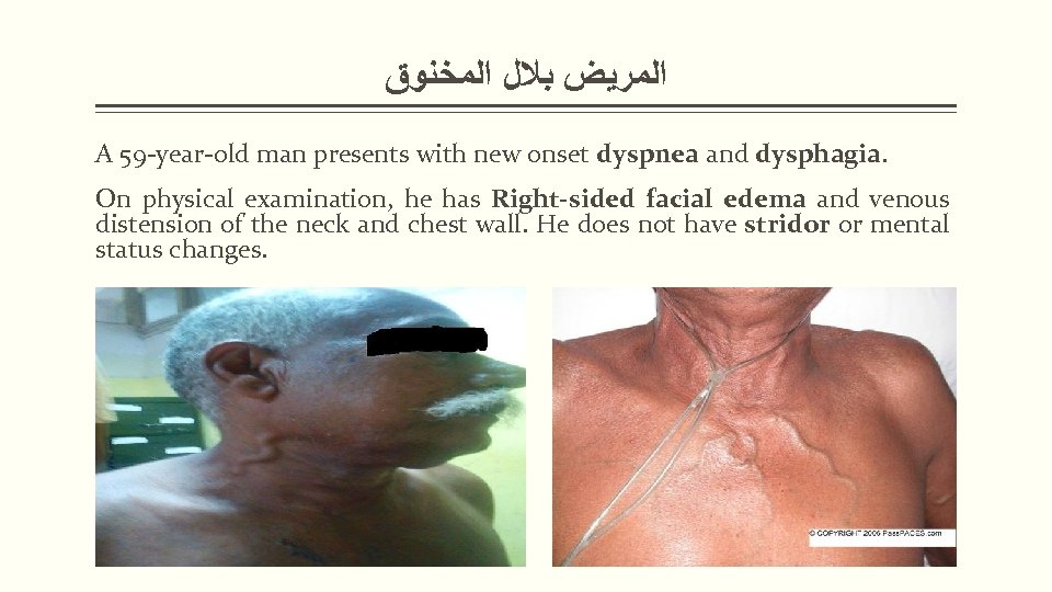 ﺍﻟﻤﺮﻳﺾ ﺑﻼﻝ ﺍﻟﻤﺨﻨﻮﻕ A 59 -year-old man presents with new onset dyspnea and