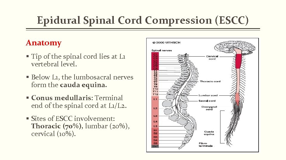 Epidural Spinal Cord Compression (ESCC) Anatomy § Tip of the spinal cord lies at