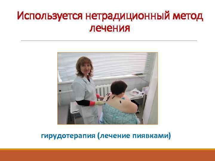 Используется нетрадиционный метод лечения гирудотерапия (лечение пиявками) 