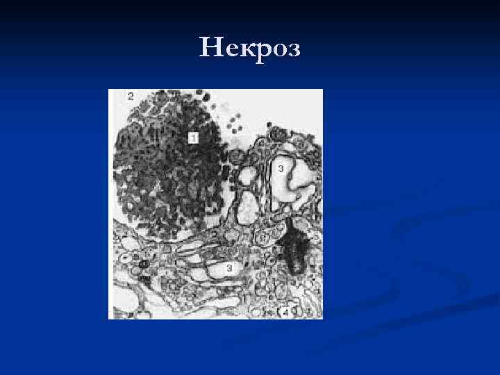 Некроз 