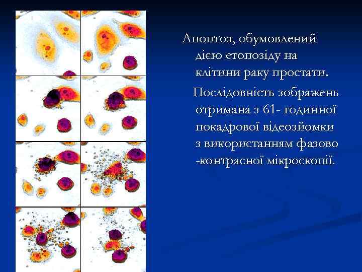 Апоптоз, обумовлений дією етопозіду на клітини раку простати. Послідовність зображень отримана з 61 -