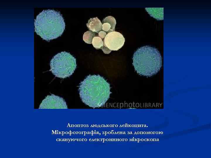 Апоптоз людського лейкоцита. Мікрофотографія, зроблена за допомогою скануючого електроннного мікроскопа 