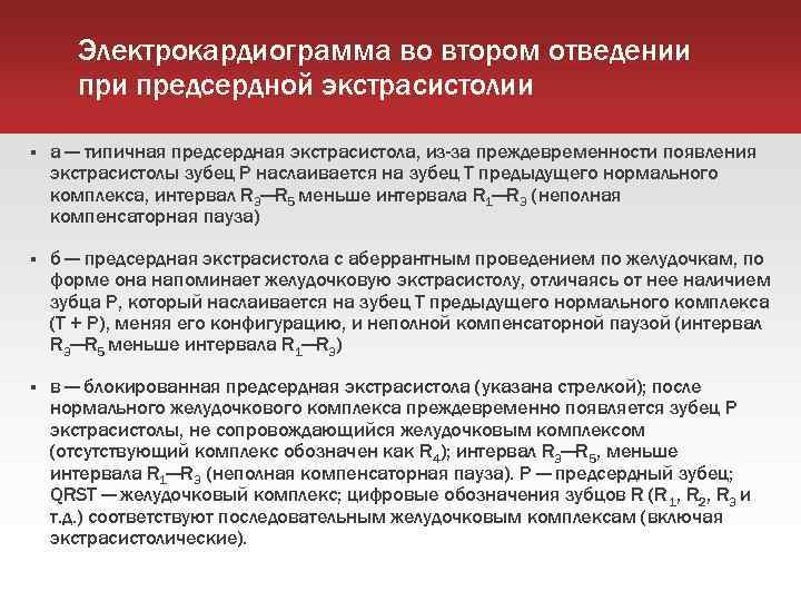 Электрокардиограмма во втором отведении предсердной экстрасистолии а — типичная предсердная экстрасистола, из-за преждевременности появления