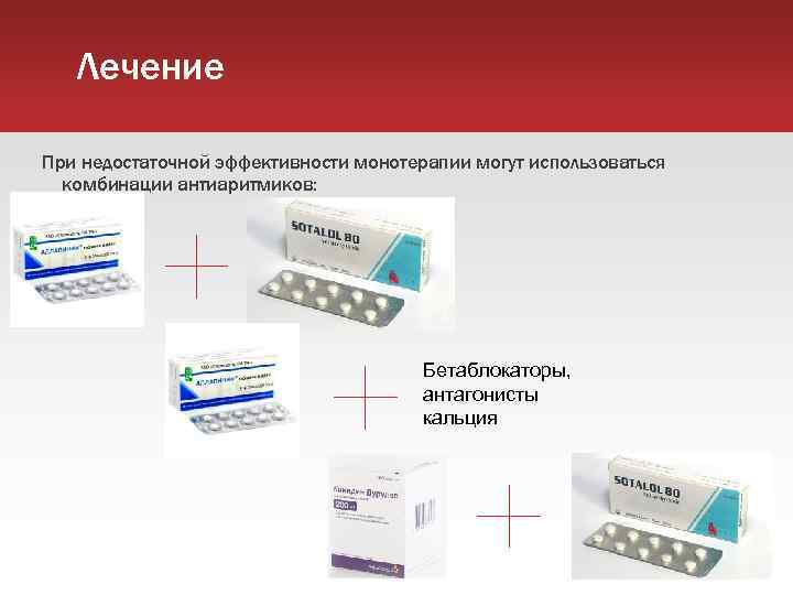 Лечение При недостаточной эффективности монотерапии могут использоваться комбинации антиаритмиков: Бетаблокаторы, антагонисты кальция 