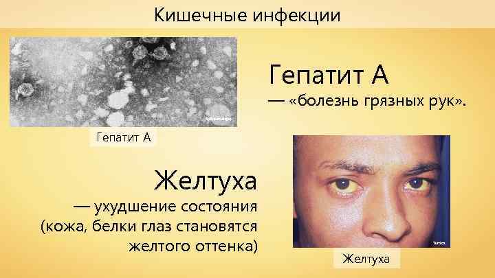 Кишечные инфекции Гепатит А — «болезнь грязных рук» . Splintercellguy Гепатит А Желтуха —