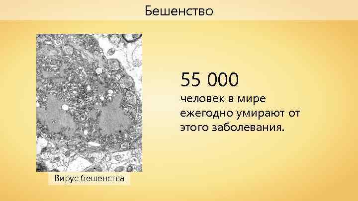 Бешенство 55 000 человек в мире ежегодно умирают от этого заболевания. Вирус бешенства 
