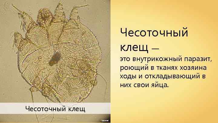 Чесоточный клещ — это внутрикожный паразит, роющий в тканях хозяина ходы и откладывающий в