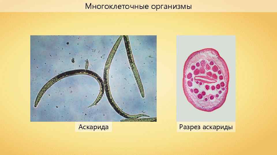 Многоклеточные организмы Аскарида Разрез аскариды 