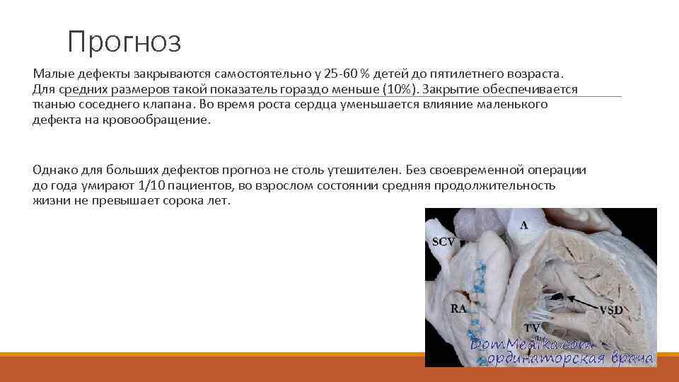Прогноз Малые дефекты закрываются самостоятельно у 25 -60 % детей до пятилетнего возраста. Для