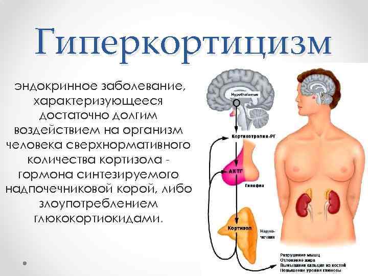 Гиперкортицизм эндокринное заболевание, характеризующееся достаточно долгим воздействием на организм человека сверхнормативного количества кортизола гормона