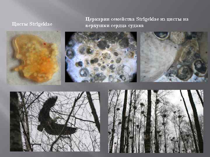 Цисты Strigeidae Церкарии семейства Strigeidae из цисты на верхушки сердца судака 