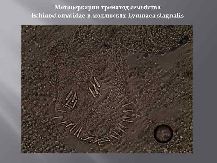 Метацеркарии трематод семейства Echinoctomatidae в моллюсках Lymnaea stagnalis 