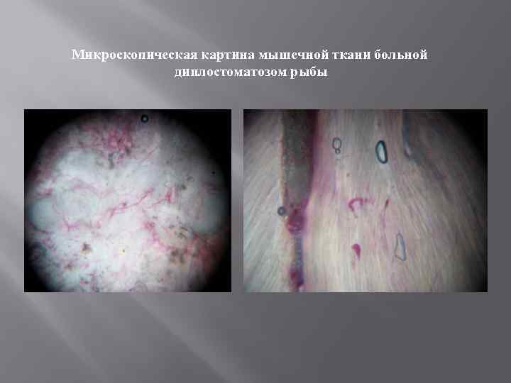 Микроскопическая картина мышечной ткани больной диплостоматозом рыбы 