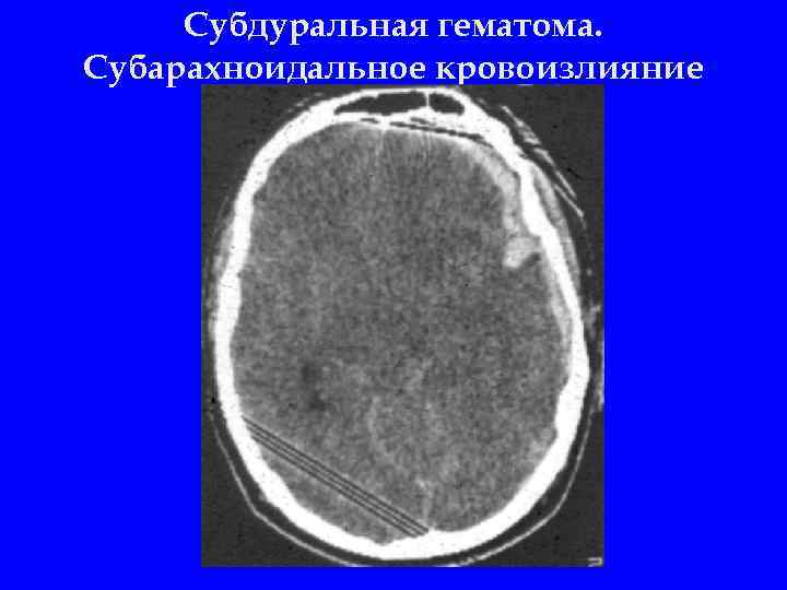 2 орлов ю а руководство по диагностике и лечению черепно мозговой травмы год выпуска 2004