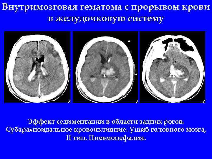 2 орлов ю а руководство по диагностике и лечению черепно мозговой травмы год выпуска 2004