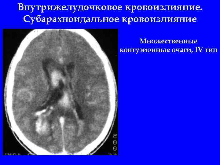 2 орлов ю а руководство по диагностике и лечению черепно мозговой травмы год выпуска 2004